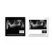Official Album MINHO The 1st Mini Album CHASE Complete Ver Random Ver