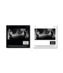 Official Album MINHO The 1st Mini Album CHASE Complete Ver Random Ver